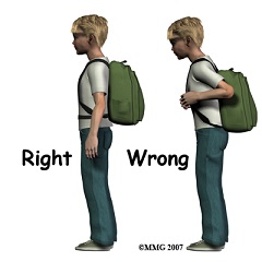 backpack_poor_posture